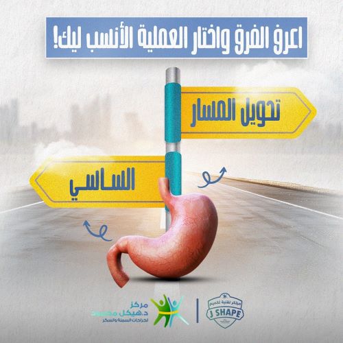 الفرق بين الساسي وتحويل المسار